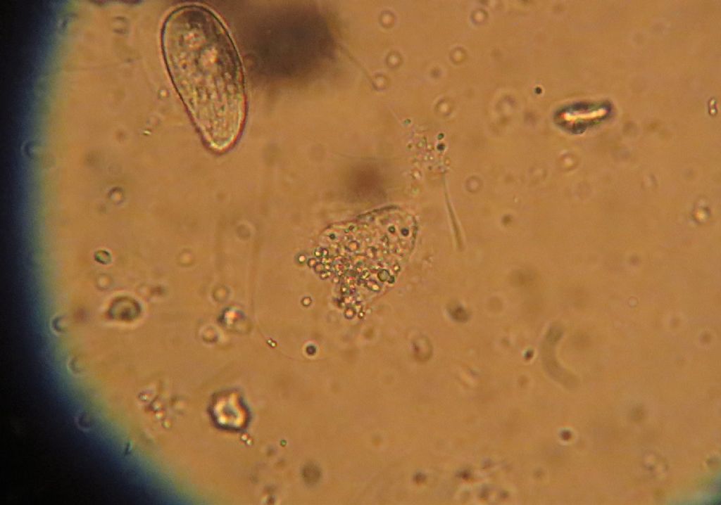 Amoeba ID